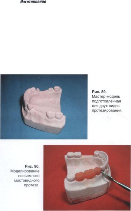 Aplicarea materialelor termoplastice în stomatologie