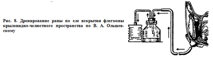 Принципи хірургічного лікування хворих з абсцесами, флегмонами голови і шиї - хороший