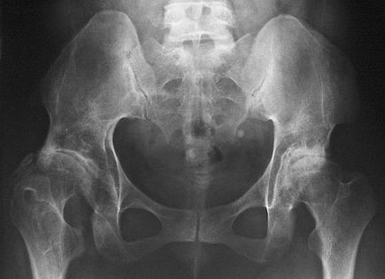 X-ray de oase pelviene cum să pregătească și norma