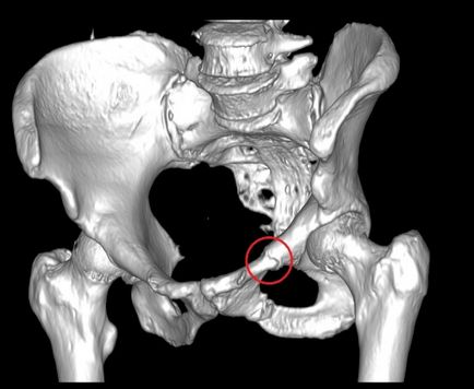 X-ray (radiografie) de pregătire a oaselor pelvine, comportament, rezultate