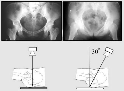 X-ray (radiografie) de pregătire a oaselor pelvine, comportament, rezultate