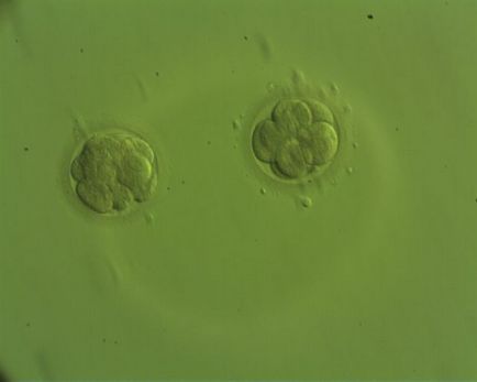 kiválasztása embriók
