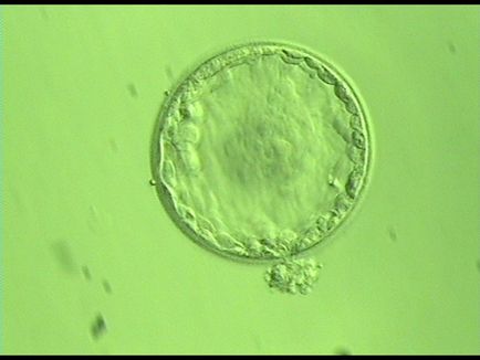Selectarea embrionilor
