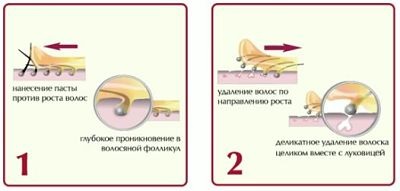 Шугарінг вусиків відгуки про самостійне проведення