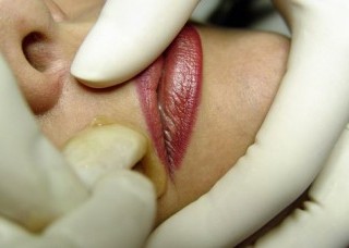 Ridicarea buzei superioare - subțierea epilării