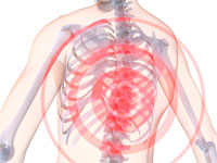 Simptomele condrozei coloanei vertebrale toracice și a semnelor sale