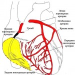 Sinus tachycardia szív, mi ez