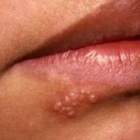 Скраб для губ правила застосування, поради та рецепти домашніх засобів