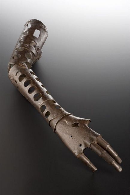 Середньовічне протезування кінцівок людини (21 фото) - Трініксі