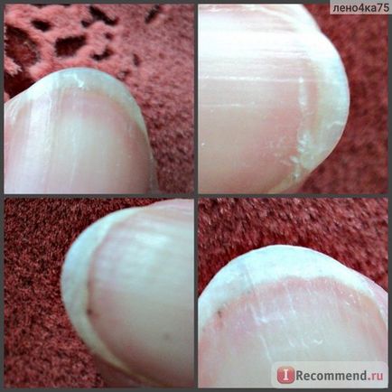 Засіб для видалення кутикули divage bb nail cure cuticle away - «ви що вибираєте кутикулу або