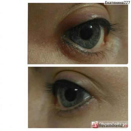 Eye tattooing - 