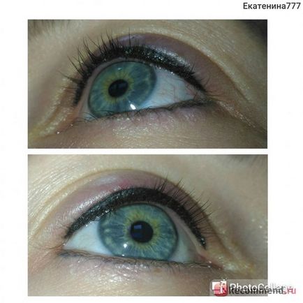 Eye tattooing - 