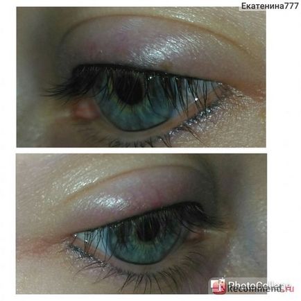 Eye tattooing - 