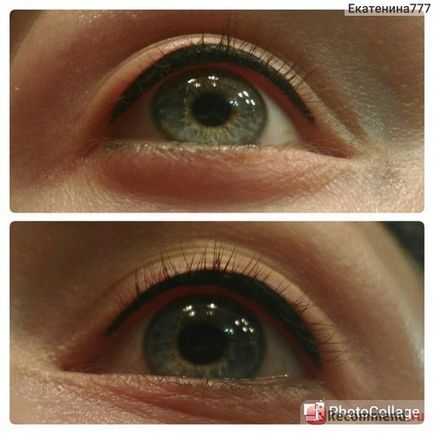 Eye tattooing - 