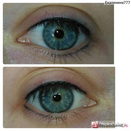 Eye tattooing - 