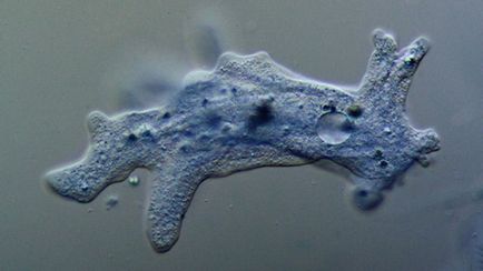 Tipurile de amoeba și varietăți de amoeba care provoacă amoebiasis și nu numai