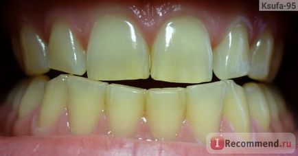 Товари для краси svabplus система для домашнього відбілювання зубів - «дурниця цей dental