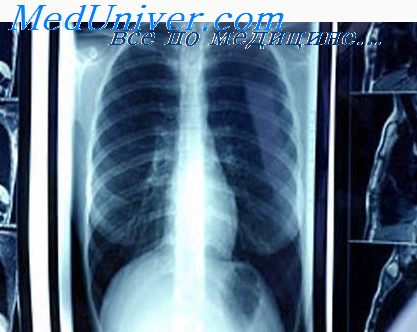 Tuberculomul și adenomatoza