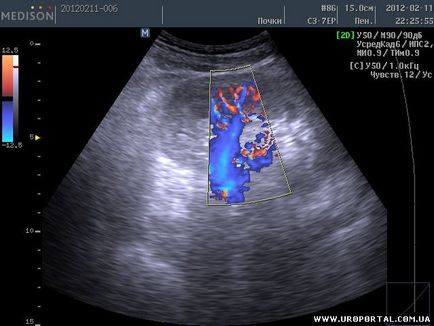 Imagini ultrasunete ale unei singure proceduri - diagnostic cu ultrasunete - metode de examinare în urologie