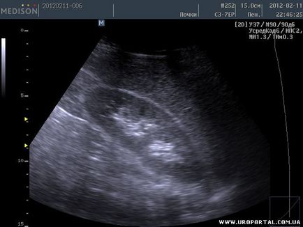 Imagini ultrasunete ale unei singure proceduri - diagnostic cu ultrasunete - metode de examinare în urologie