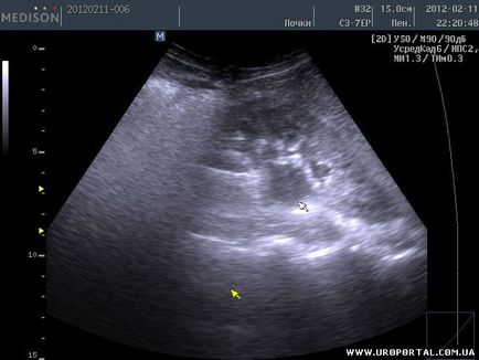 Imagini ultrasunete ale unei singure proceduri - diagnostic cu ultrasunete - metode de examinare în urologie