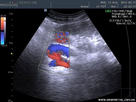 Imagini ultrasunete ale unei singure proceduri - diagnostic cu ultrasunete - metode de examinare în urologie