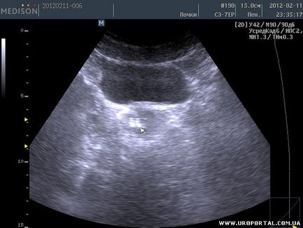 Imagini ultrasunete ale unei singure proceduri - diagnostic cu ultrasunete - metode de examinare în urologie