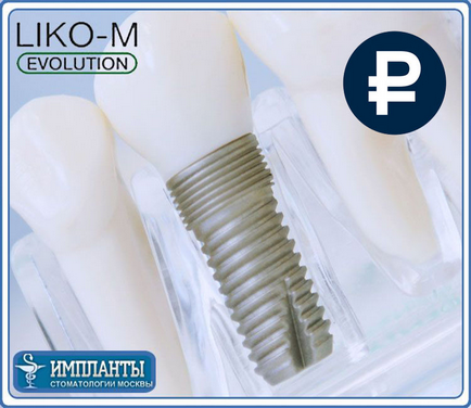 Pentru a monta implanturi dentare lico - implantate imoabili ruși liko (niko) la un preț accesibil