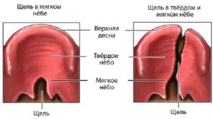 Верхня щелепа людини будова (анатомія) - контрфорси, відростки і інше