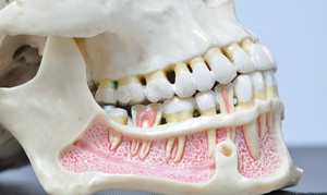 Structura maxilară umană superioară (anatomie) - contraforturi, varză și altele