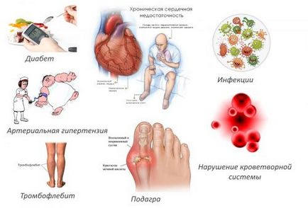 Halus valgus tipuri de funcționare și caracteristicile procedurii