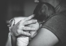 A sebész koponya összegyűjtött darabokra beteg féle (koponya) Sebész darabokat gyűjtött a koponya a beteg, INA