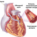 Tratamentul cu colecistita cu remedii folclorice