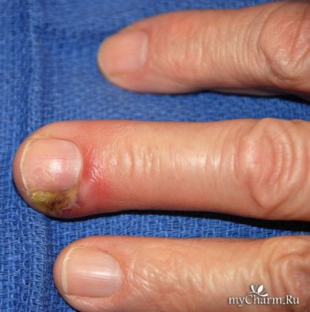 Boli ale pielii mâinilor și unghiilor manichiură de grup, pedichiură