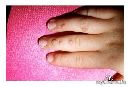 bőrbetegség a kéz és a körmök Group manikűr, pedikűr