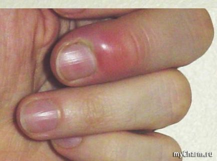 bőrbetegség a kéz és a körmök Group manikűr, pedikűr