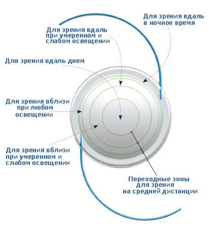 Chirurgie de înlocuire a lentilelor, Moscova - metode de tratament