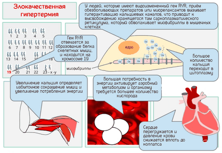 Malignă hipertermie - cauze, simptome și tratament