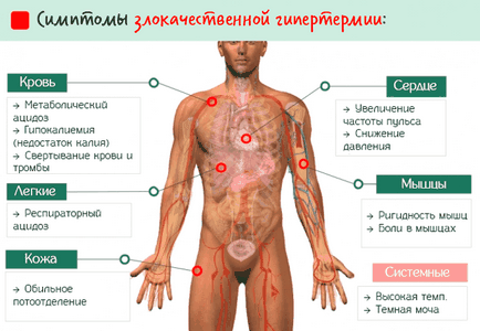 Malignă hipertermie - cauze, simptome și tratament