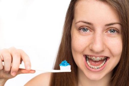 fogszabályozó fogkrém kell különleges