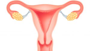 Adenomyosis és a terhesség teherbeesés ezt az elemzést