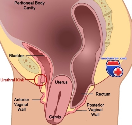 Agenția vaginală