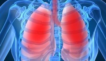 Allergiás bronchitis típusai és tünetei felnőtteknél és gyermekeknél