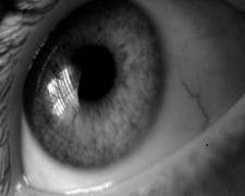 Angiopatia retiniană