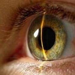 Angiopatia retiniană
