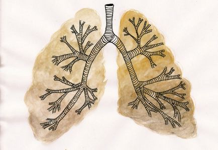 Bronchitis a terhesség alatt a tünetek, a kezelés