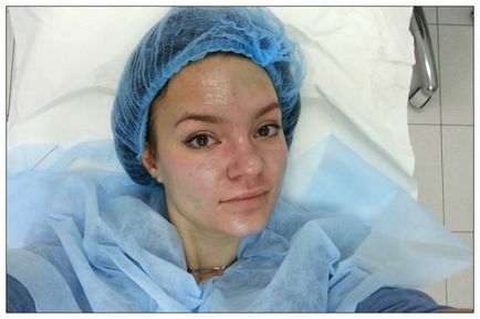 Curățarea feței și peelingul în centrul cosmetologiei medicale - petrovka-frumusete - vârful și