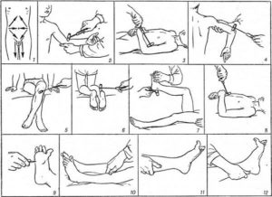 Care este schema reflexă a arcului reflex al lui Ahile, descrierea și verificarea lui