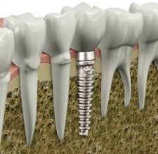 Експерти підвищують безпеку стоматологічних процедур