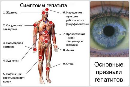 Фітопрепарати, трав'яні збори та чаї проти хвороби печінки